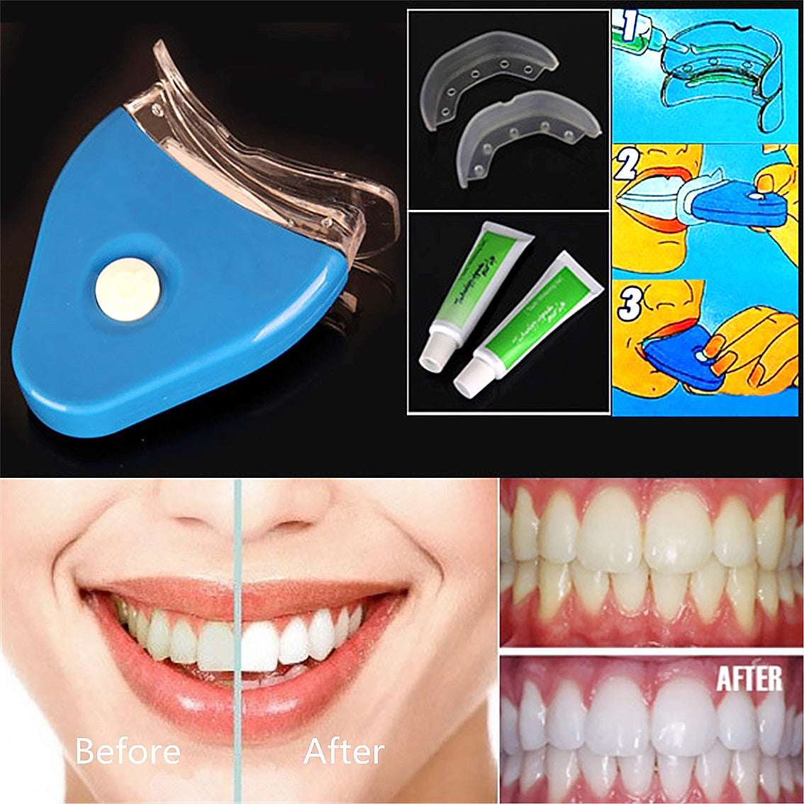Oral Gel Teeth Tooth Whitening Whitener Dental Bleaching LED,Dental Bleaching Technology